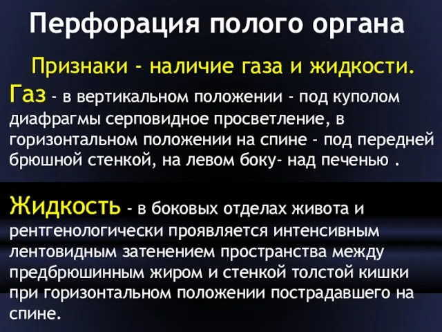 Перфорация полого органа Признаки - наличие газа и жидкости. Газ -