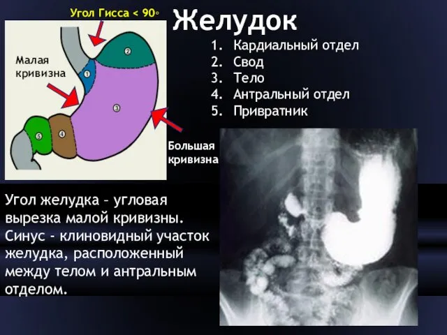 Желудок Кардиальный отдел Свод Тело Антральный отдел Привратник Угол Гисса Малая