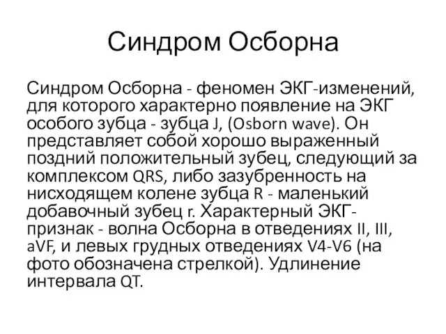 Синдром Осборна Синдром Осборна - феномен ЭКГ-изменений, для которого характерно появление