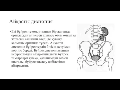 Айқасты дистопия Екі бүйрек те омыртқаның бір жағында орналасқан ал несеп