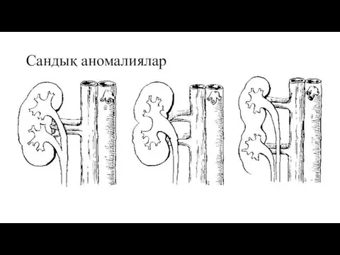 Сандық аномалиялар Аплазия-