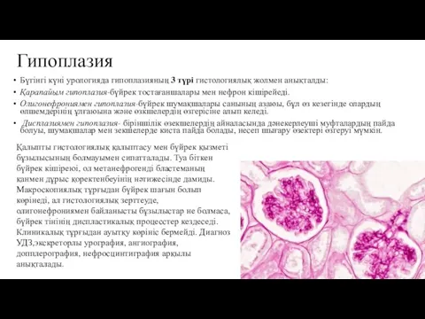 Гипоплазия Бүгінгі күні урологияда гипоплазияның 3 түрі гистологиялық жолмен анықталды: Қарапайым