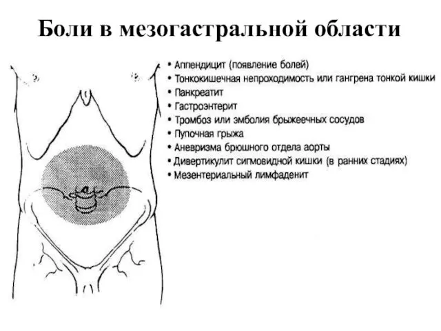 Боли в мезогастральной области