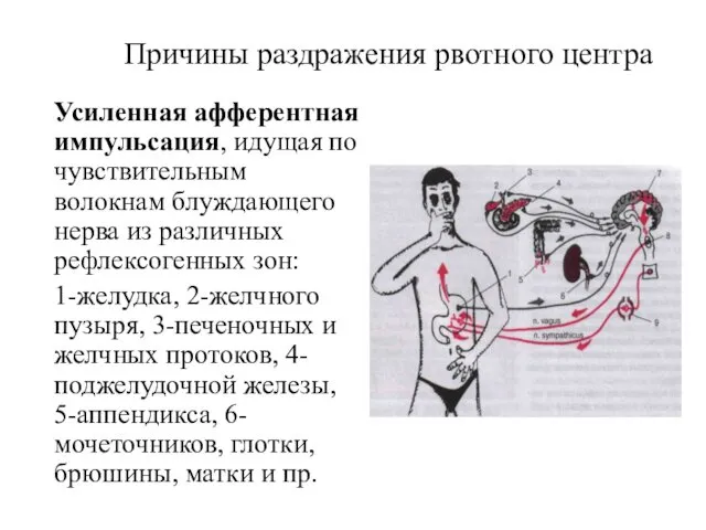 Причины раздражения рвотного центра Усиленная афферентная импульсация, идущая по чувствительным волокнам