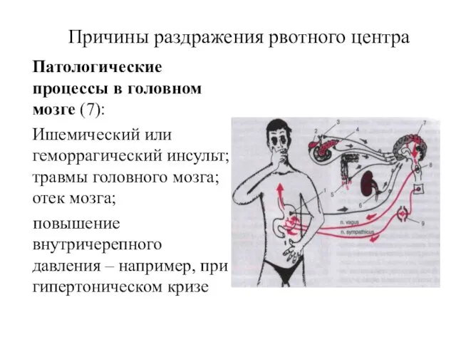 Причины раздражения рвотного центра Патологические процессы в головном мозге (7): Ишемический