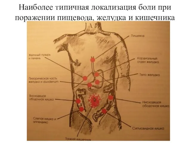 Наиболее типичная локализация боли при поражении пищевода, желудка и кишечника