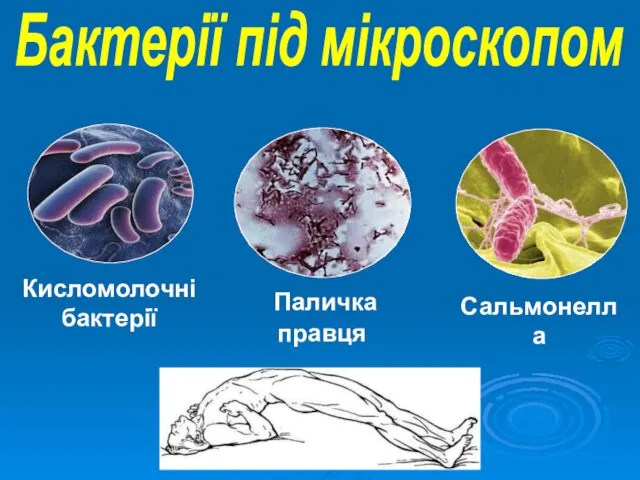 Сальмонелла Паличка правця Бактерії під мікроскопом Кисломолочні бактерії