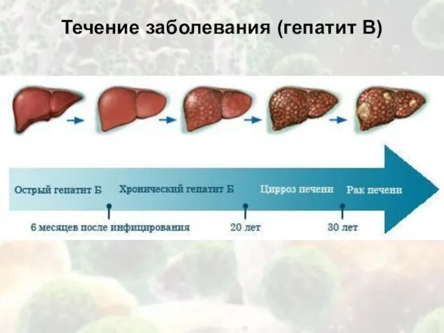 Течение заболевания (гепатит В)