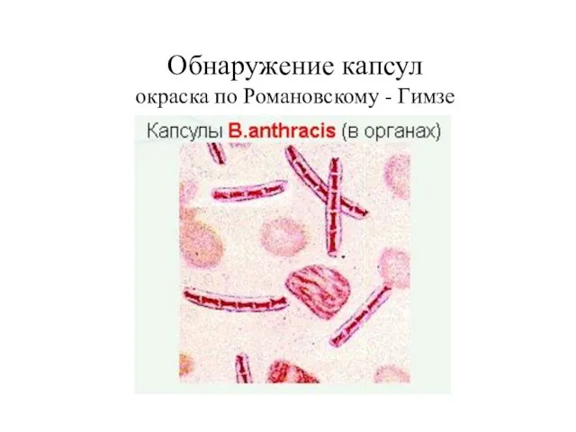 Обнаружение капсул окраска по Романовскому - Гимзе