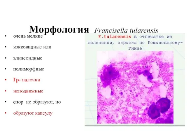 Морфология Francisella tularensis очень мелкие кокковидные или элипсоидные полиморфные Гр- палочки