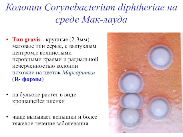 Колонии Corynebacterium diphtheriae на среде Мак-лауда Тип gravis - крупные (2-3мм)