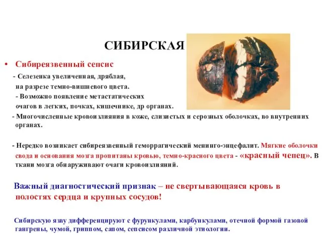 СИБИРСКАЯ ЯЗВА Сибиреязвенный сепсис - Селезенка увеличенная, дряблая, на разрезе темно-вишневого