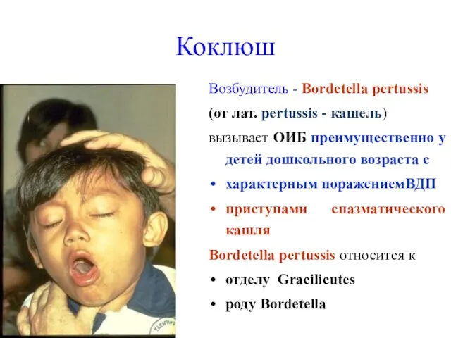 Коклюш Возбудитель - Bordetella pertussis (от лат. pertussis - кашель) вызывает