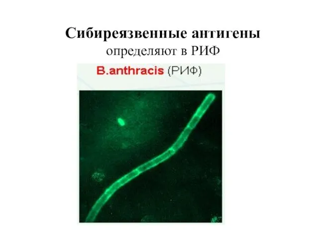 Сибиреязвенные антигены определяют в РИФ