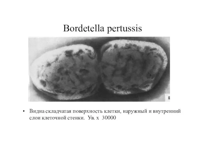 Bordetella pertussis Видна складчатая поверхность клетки, наружный и внутренний слои клеточной стенки. Ув. х 30000