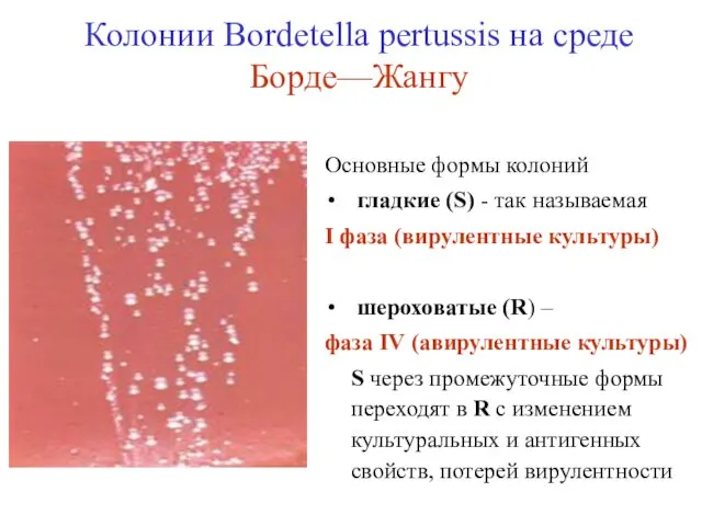 Колонии Bordetella pertussis на среде Борде—Жангу Основные формы колоний гладкие (S)