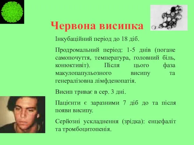 Червона висипка Інкубаційний період до 18 діб. Продромальний період: 1-5 днів