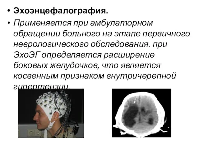 Эхоэнцефалография. Применяется при амбулаторном обращении больного на этапе первичного неврологического обследования.