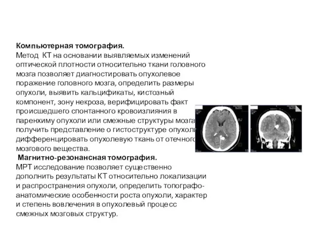 Компьютерная томография. Метод КТ на основании выявляемых изменений оптической плотности относительно