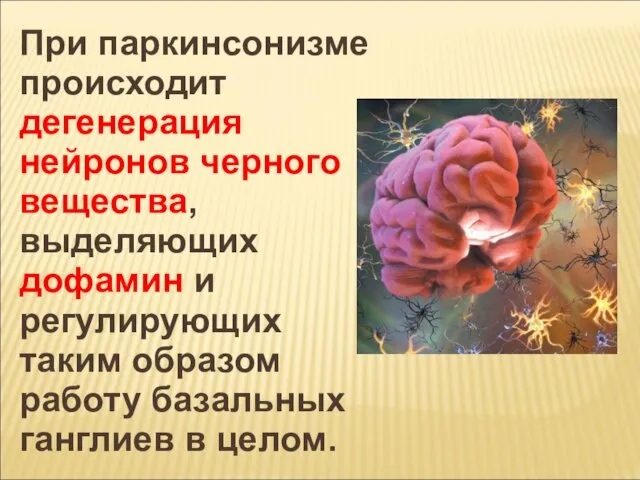 При паркинсонизме происходит дегенерация нейронов черного вещества, выделяющих дофамин и регулирующих