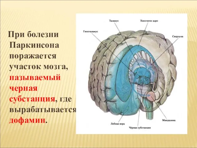 При болезни Паркинсона поражается участок мозга, называемый черная субстанция, где вырабатывается дофамин.