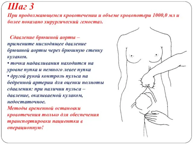 Шаг 3 При продолжающемся кровотечении и объеме кровопотери 1000,0 мл и