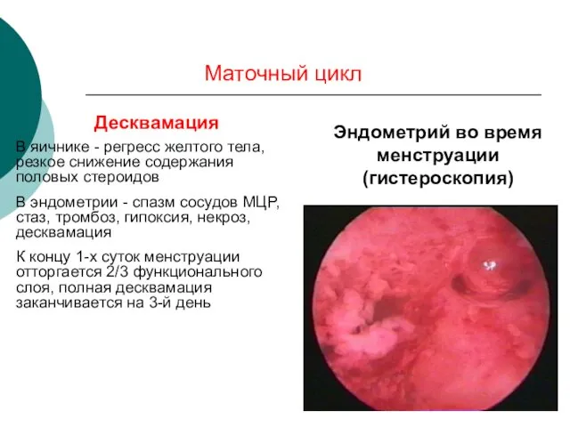 Маточный цикл Десквамация В яичнике - регресс желтого тела, резкое снижение