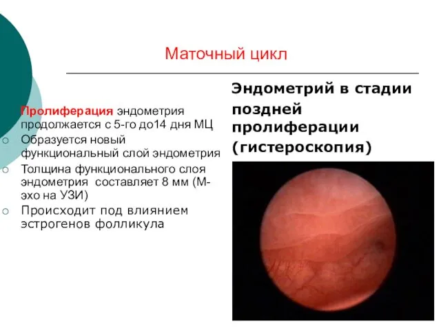 Маточный цикл Эндометрий в стадии поздней пролиферации (гистероскопия) Пролиферация эндометрия продолжается