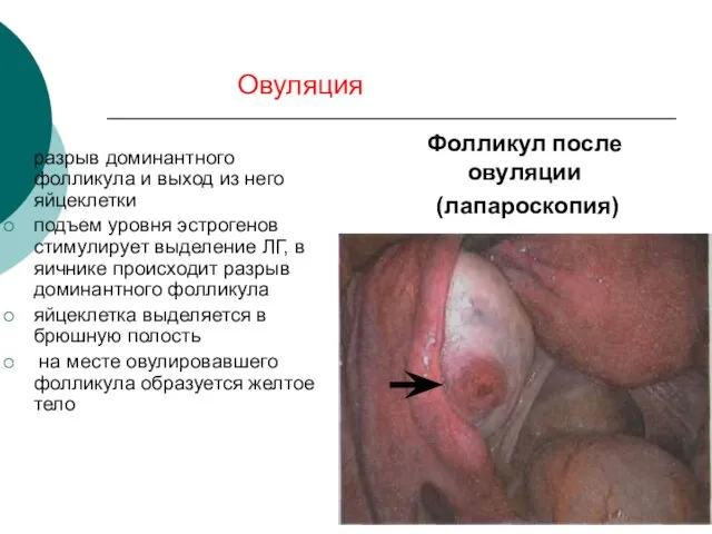 разрыв доминантного фолликула и выход из него яйцеклетки подъем уровня эстрогенов