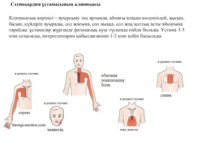 Стенокардия ұстамасының клиникасы Клиникалық көрінісі – ауырсыну төс артында, аймағы алақан