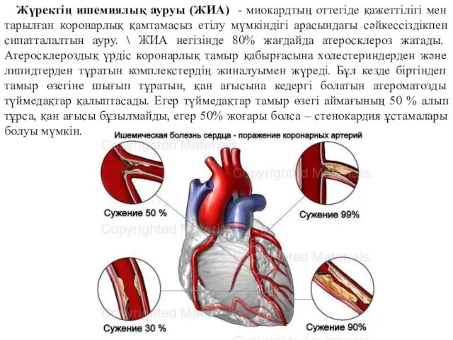 Жүректің ишемиялық ауруы (ЖИА) - миокардтың оттегіде қажеттілігі мен тарылған коронарлық