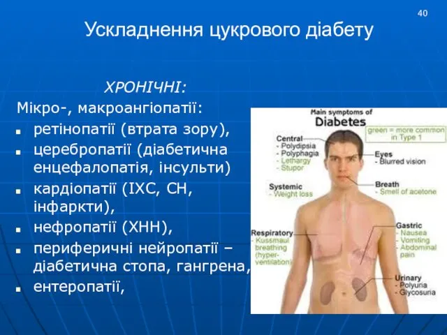 Ускладнення цукрового діабету ХРОНІЧНІ: Мікро-, макроангіопатії: ретінопатії (втрата зору), церебропатії (діабетична