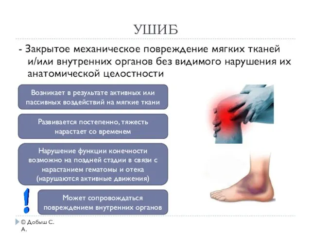 УШИБ - Закрытое механическое повреждение мягких тканей и/или внутренних органов без