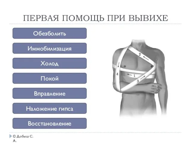 ПЕРВАЯ ПОМОЩЬ ПРИ ВЫВИХЕ © Добыш С.А. Обезболить Иммобилизация Холод Покой Вправление Наложение гипса Восстановление