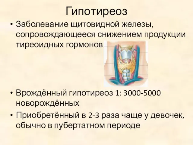 Гипотиреоз Заболевание щитовидной железы, сопровождающееся снижением продукции тиреоидных гормонов Врождённый гипотиреоз