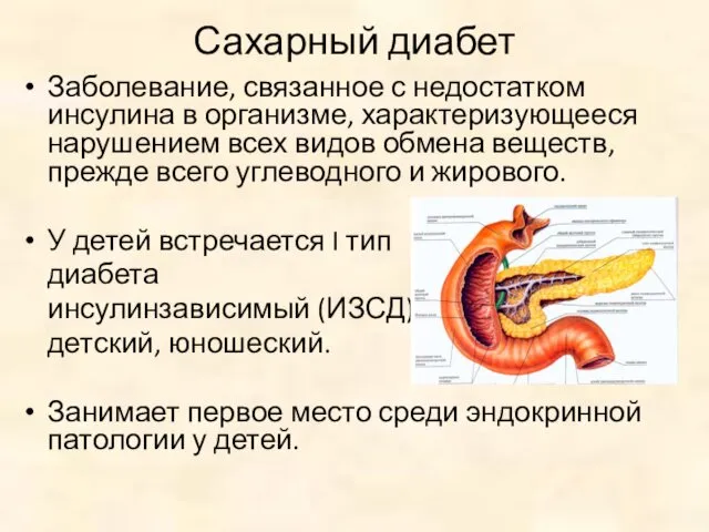 Сахарный диабет Заболевание, связанное с недостатком инсулина в организме, характеризующееся нарушением