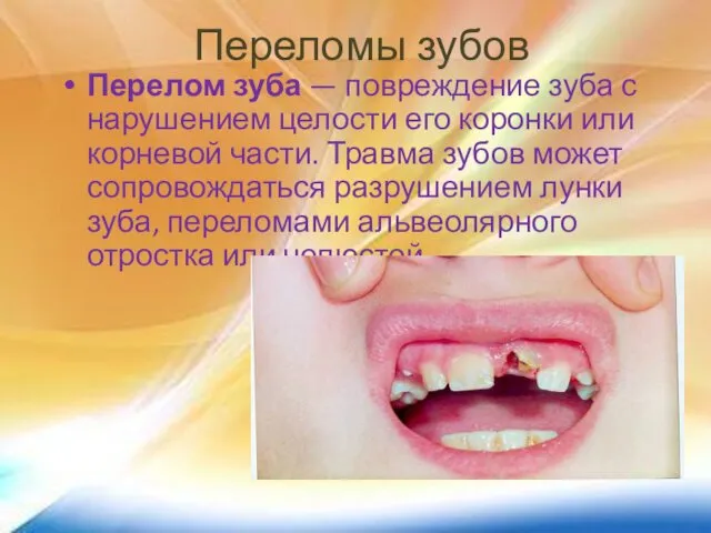 Переломы зубов Перелом зуба — повреждение зуба с нарушением целости его