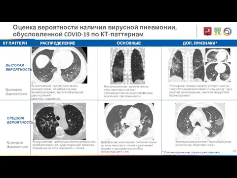 Оценка вероятности наличия вирусной пневмонии, обусловленной COVID-19 по КТ-паттернам КТ ПАТТЕРН