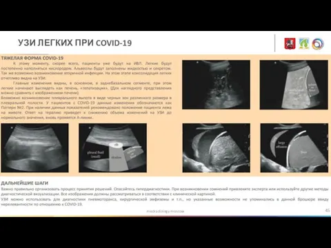 medradiology.moscow УЗИ ЛЕГКИХ ПРИ COVID-19