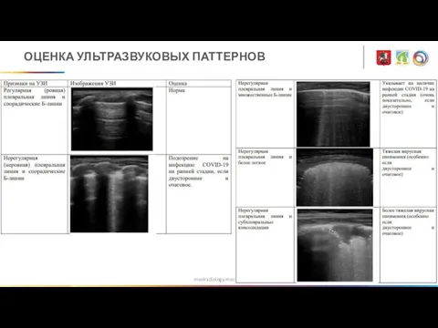 medradiology.moscow ОЦЕНКА УЛЬТРАЗВУКОВЫХ ПАТТЕРНОВ