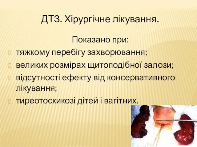 ДТЗ. Хірургічне лікування. Показано при: тяжкому перебігу захворювання; великих розмірах щитоподібної