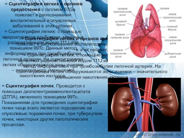 = Сцинтиграфия легких и органов средостения с галлием 67Ga помогает в