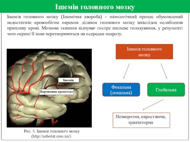 Ішемія головного мозку Ішемія головного мозку (Ішемічна хвороба) – патологічний процес