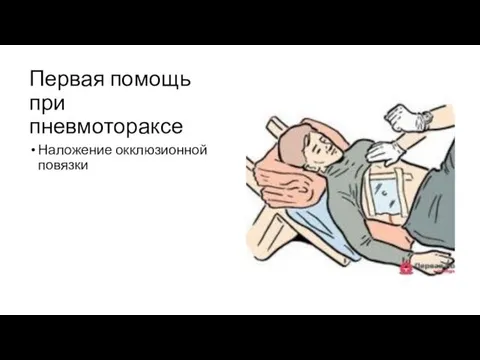 Первая помощь при пневмотораксе Наложение окклюзионной повязки