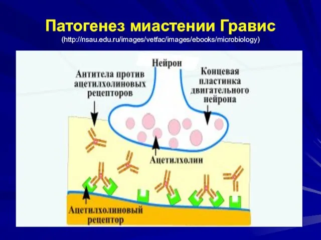 Патогенез миастении Гравис (http://nsau.edu.ru/images/vetfac/images/ebooks/microbiology)