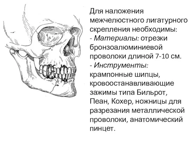 Для наложения межчелюстного лигатурного скрепления необходимы: - Материалы: отрезки бронзоалюминиевой проволоки