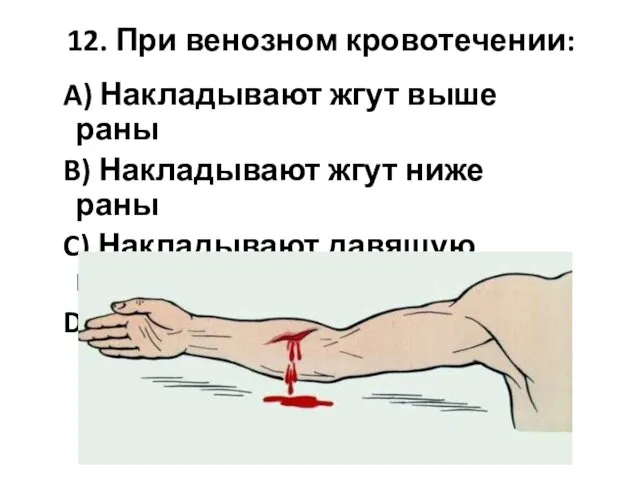 12. При венозном кровотечении: A) Накладывают жгут выше раны B) Накладывают