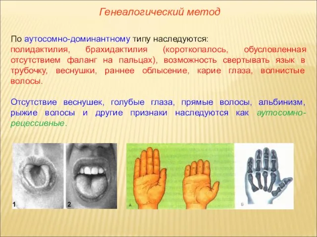 Генеалогический метод По аутосомно-доминантному типу наследуются: полидактилия, брахидактилия (короткопалось, обусловленная отсутствием