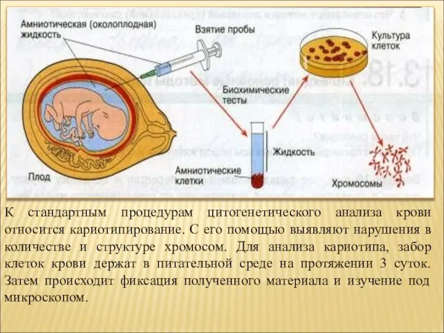 К стандартным процедурам цитогенетического анализа крови относится кариотипирование. С его помощью