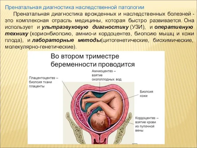 Пренатальная диагностика наследственной патологии Пренатальная диагностика врожденных и наследственных болезней -